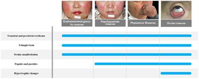 Role of the skin microbiota and intestinal microbiome in rosacea